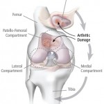 Kinamed_patientinfo_fig3_large