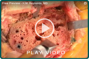 video_thumb_carbojet_reynolds