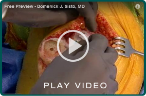 video_thumb_kinematch_sisto2