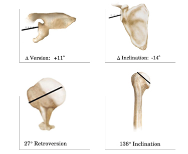 navi4ImagesShoulder